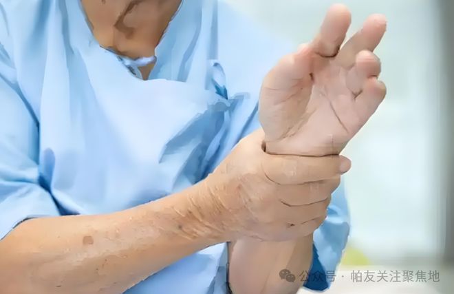 特发性震颤只治手抖？小心那些被忽视的致命隐患(图3)