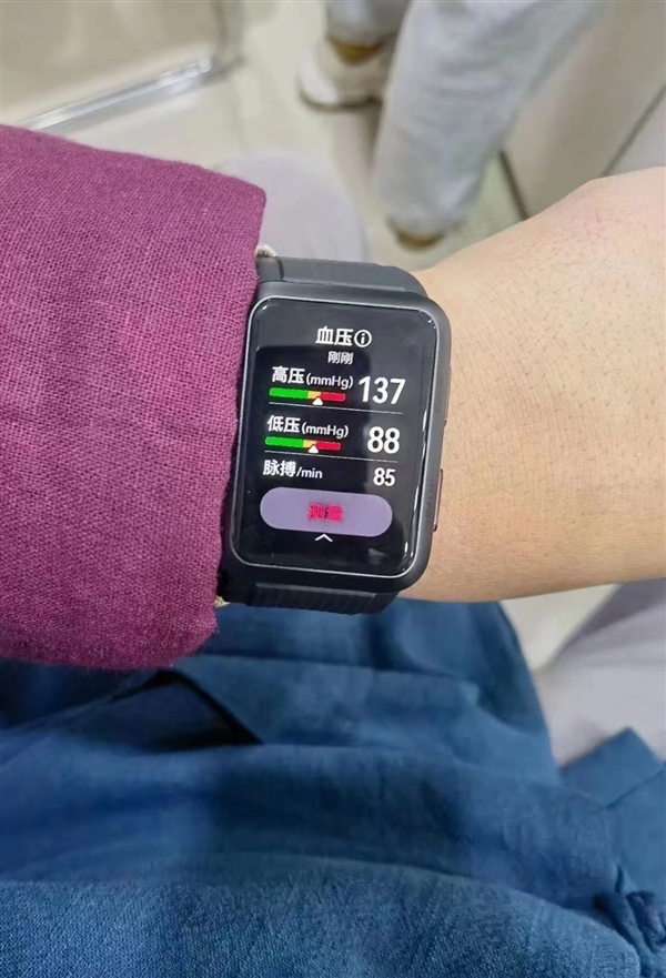 2025智能手表终极对决：八大品牌优缺点全解析看完再买不后悔！(图1)