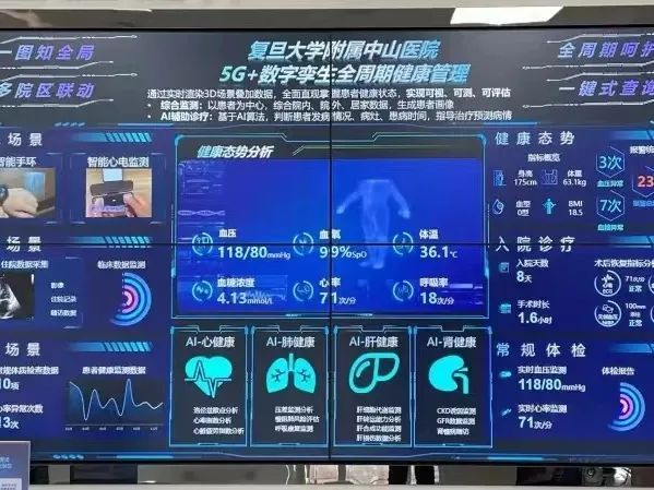 iQOO WATCH5支持电竞游戏模式 可记录游戏时心率变化(图1)